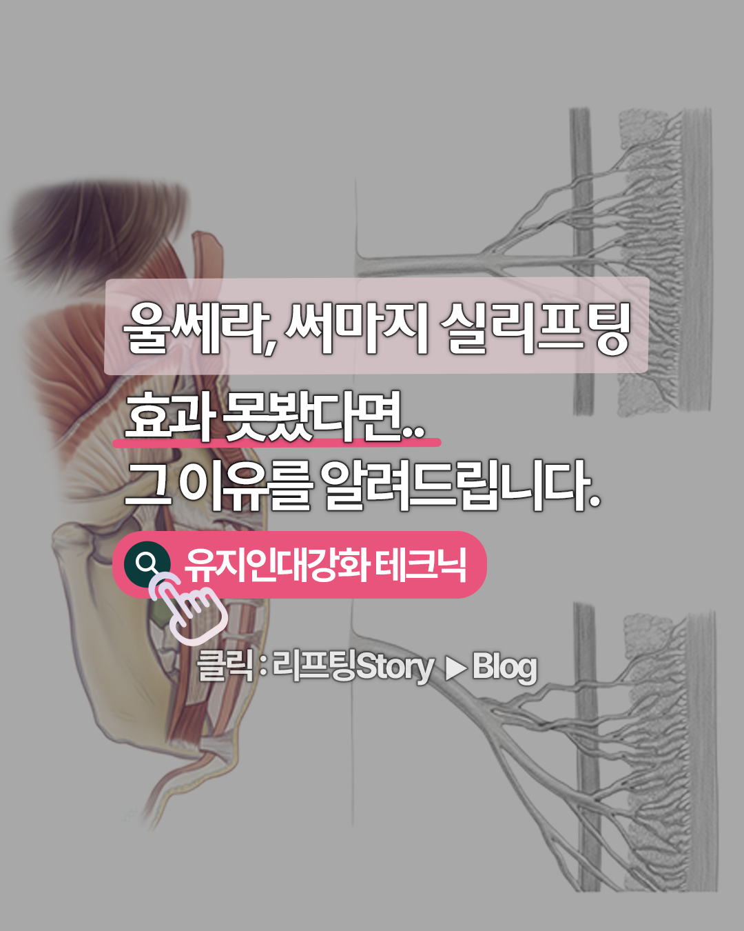 유지인대강화 테크닉